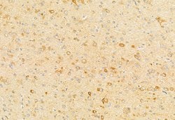 Invitrogen TPL2 Polyclonal Antibody 100 &mu;L; Unconjugated:Antibodies,