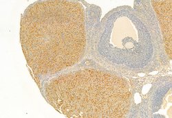 Invitrogen TPL2 Polyclonal Antibody 100 &mu;L; Unconjugated:Antibodies,