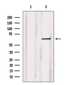 Invitrogen TPL2 Polyclonal Antibody 100 &mu;L; Unconjugated:Antibodies,