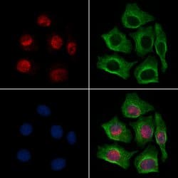 Invitrogen MAPKAPK3 Polyclonal Antibody 100 &mu;L; Unconjugated:Antibodies,