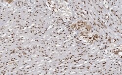 Invitrogen MAPKAPK3 Polyclonal Antibody 100 &mu;L; Unconjugated:Antibodies,