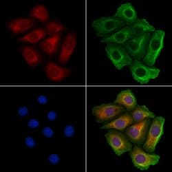 Invitrogen MARS Polyclonal Antibody 100 &mu;L; Unconjugated:Antibodies,