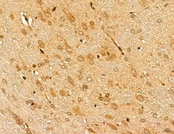Invitrogen MARS Polyclonal Antibody 100 &mu;L; Unconjugated:Antibodies,
