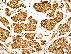 Invitrogen MARS Polyclonal Antibody 100 &mu;L; Unconjugated:Antibodies,