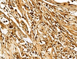 Invitrogen MARS Polyclonal Antibody 100 &mu;L; Unconjugated:Antibodies,