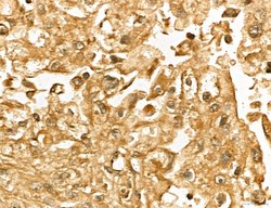 Invitrogen MARS Polyclonal Antibody 100 &mu;L; Unconjugated:Antibodies,