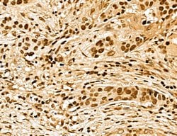 Invitrogen MARS Polyclonal Antibody 100 &mu;L; Unconjugated:Antibodies,