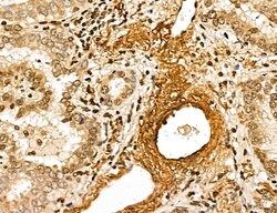 Invitrogen MARS Polyclonal Antibody 100 &mu;L; Unconjugated:Antibodies,