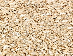 Invitrogen MARS Polyclonal Antibody 100 &mu;L; Unconjugated:Antibodies,