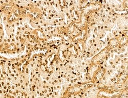 Invitrogen MARS Polyclonal Antibody 100 &mu;L; Unconjugated:Antibodies,