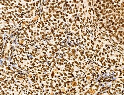 Invitrogen MARS Polyclonal Antibody 100 &mu;L; Unconjugated:Antibodies,