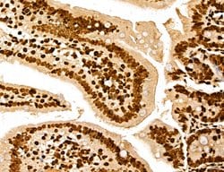 Invitrogen MARS Polyclonal Antibody 100 &mu;L; Unconjugated:Antibodies,