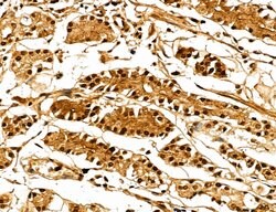 Invitrogen MARS Polyclonal Antibody 100 &mu;L; Unconjugated:Antibodies,