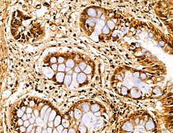 Invitrogen MARS Polyclonal Antibody 100 &mu;L; Unconjugated:Antibodies,