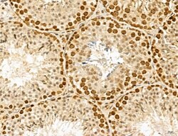 Invitrogen MAT2A Polyclonal Antibody 100 &mu;L; Unconjugated:Antibodies,
