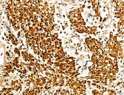 Invitrogen MAT2A Polyclonal Antibody 100 &mu;L; Unconjugated:Antibodies,