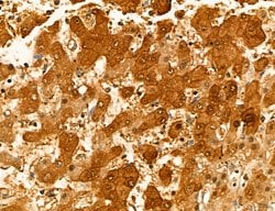 Invitrogen MAT2A Polyclonal Antibody 100 &mu;L; Unconjugated:Antibodies,