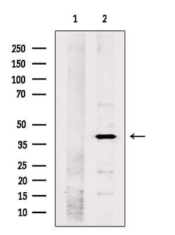 Invitrogen MBD2 Polyclonal Antibody 100 &mu;L; Unconjugated:Antibodies,