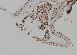 Invitrogen MCM6 Polyclonal Antibody 100 μL; Unconjugated:Antibodies,