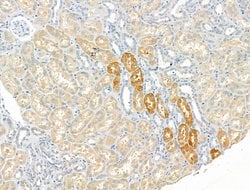 ZC3H12A Polyclonal Antibody:Antibodies, Polyclonal