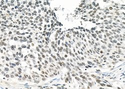 Invitrogen MED31 Polyclonal Antibody 100 &mu;L; Unconjugated:Antibodies,
