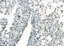 Invitrogen MED31 Polyclonal Antibody 100 &mu;L; Unconjugated:Antibodies,