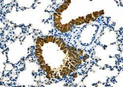 Invitrogen MED31 Polyclonal Antibody 100 &mu;L; Unconjugated:Antibodies,