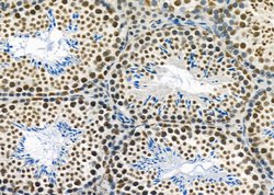 Invitrogen MED31 Polyclonal Antibody 100 &mu;L; Unconjugated:Antibodies,
