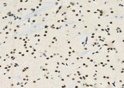 Invitrogen MED31 Polyclonal Antibody 100 &mu;L; Unconjugated:Antibodies,
