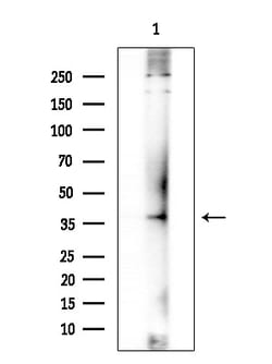 Invitrogen MEIS1 Polyclonal Antibody 100 &mu;L | Buy Online | Invitrogen&trade; | Fisher Scientific