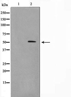 Invitrogen Menin Polyclonal Antibody 100 &mu;L; Unconjugated:Antibodies,