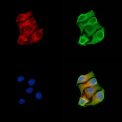 Invitrogen MUT Polyclonal Antibody 100 &mu;L | Buy Online | Invitrogen&trade; | Fisher Scientific