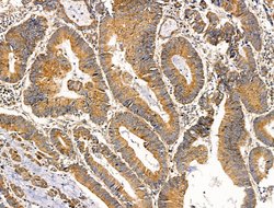 Invitrogen MUT Polyclonal Antibody 100 &mu;L | Buy Online | Invitrogen&trade; | Fisher Scientific
