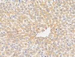 Invitrogen MUT Polyclonal Antibody 100 &mu;L | Buy Online | Invitrogen&trade; | Fisher Scientific