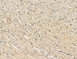 Invitrogen METL5 Polyclonal Antibody 100 &mu;L; Unconjugated:Antibodies,
