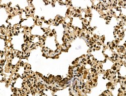 Invitrogen METTL1 Polyclonal Antibody 100 &mu;L | Buy Online | Invitrogen&trade; | Fisher Scientific