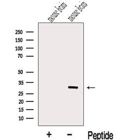 Invitrogen METTL1 Polyclonal Antibody 100 &mu;L | Buy Online | Invitrogen&trade; | Fisher Scientific