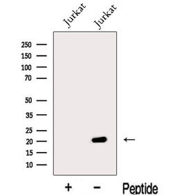 Invitrogen MFAP5 Polyclonal Antibody 100 &mu;L | Buy Online | Invitrogen&trade; | Fisher Scientific