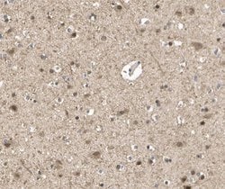 Invitrogen mGluR7 Polyclonal Antibody 100 &mu;L; Unconjugated:Antibodies,
