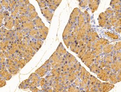 Invitrogen MIS12 Polyclonal Antibody 100 &mu;L; Unconjugated:Antibodies,