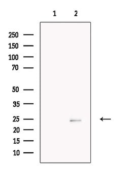 Invitrogen MIS12 Polyclonal Antibody 100 &mu;L; Unconjugated:Antibodies,