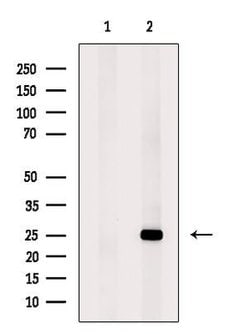 Invitrogen MIS12 Polyclonal Antibody 100 &mu;L; Unconjugated:Antibodies,