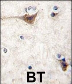 Invitrogen CDH10 Polyclonal Antibody 400 μL; Unconjugated:Antibodies,