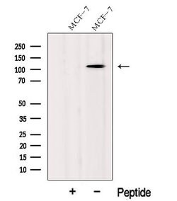 Invitrogen CASC3 Polyclonal Antibody 100 &mu;L; Unconjugated:Antibodies,