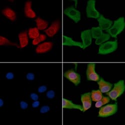 Invitrogen MMP1 Polyclonal Antibody 100 &mu;L; Unconjugated:Antibodies,