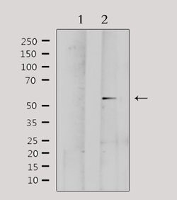 Invitrogen MMP1 Polyclonal Antibody 100 &mu;L; Unconjugated:Antibodies,