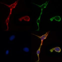 Invitrogen MMP2 Polyclonal Antibody 100 &mu;L; Unconjugated:Antibodies,
