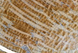 Invitrogen MMP2 Polyclonal Antibody 100 &mu;L; Unconjugated:Antibodies,