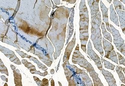 Invitrogen MMP2 Polyclonal Antibody 100 &mu;L; Unconjugated:Antibodies,