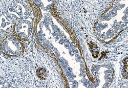 Invitrogen MMP2 Polyclonal Antibody 100 &mu;L; Unconjugated:Antibodies,